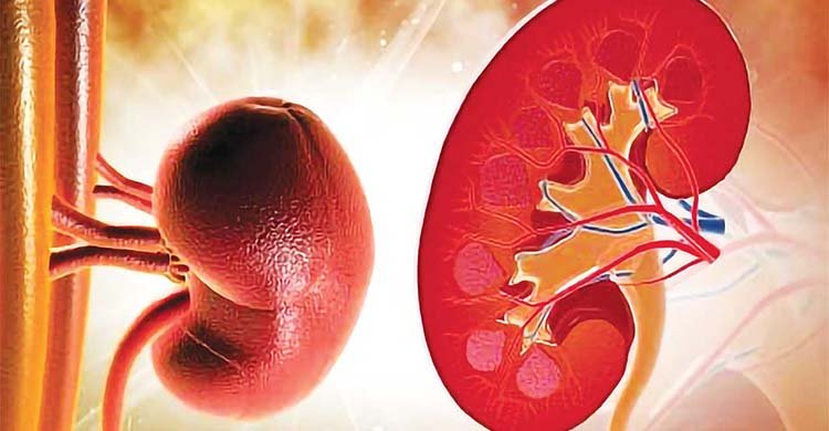 কিডনির ক্রিয়েটিনিনের মাত্রা নিয়ন্ত্রণ করবেন কী করে