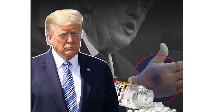 টেবিলের কোনায় আঘাতেই হাতে কালশিটে দাগ, উচ্চমাত্রার অ্যাসপিরিন সেবনও একটা কারণ বললেন ট্রাম্প