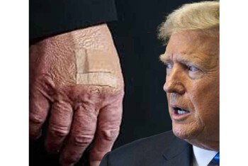 আপনার হাতে কেন কালশিটের দাগ? প্রশ্ন শুনে ট্রাম্পের জবাব: চলুন, আমার স্বাস্থ্য নিয়ে আবার আলোচনা করি! কী কী বললেন