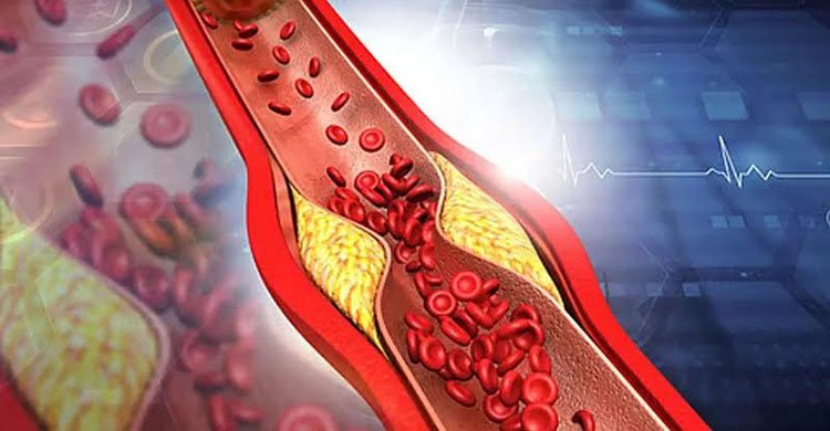 কোলেস্টেরল কমাতে উপকারী ভেষজ